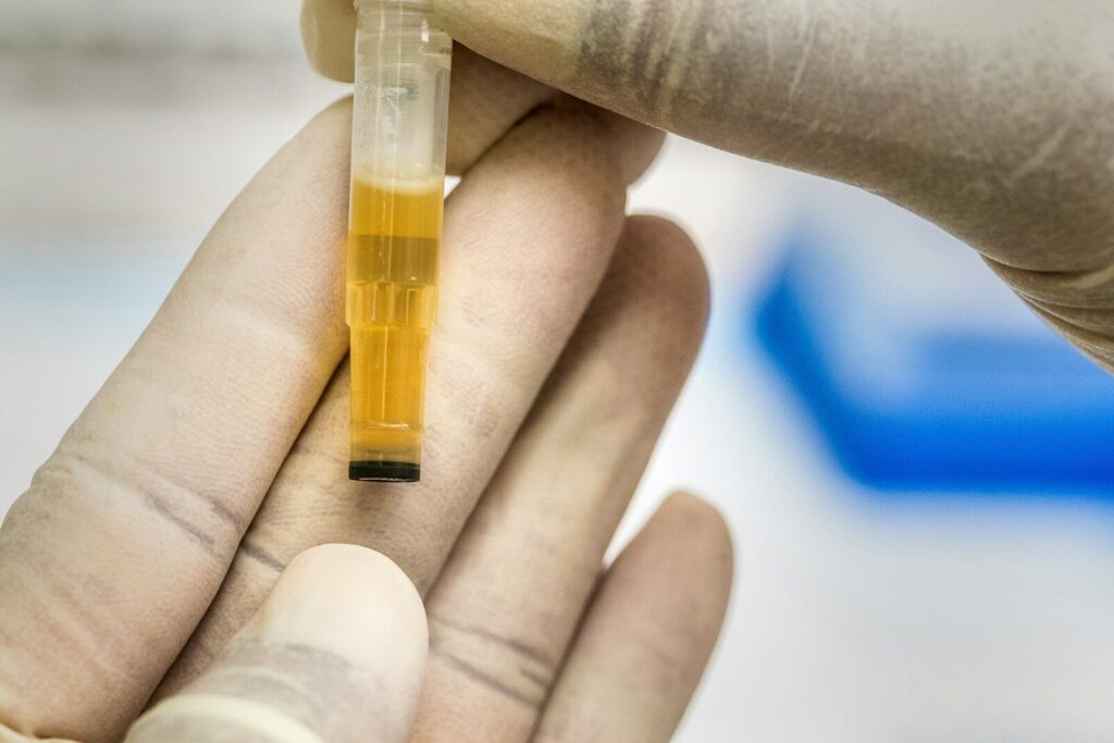 How Long Does Oxycodone Stay in Urine? Detection Time and Key Factors Explained how long does oxycodone stay in urine