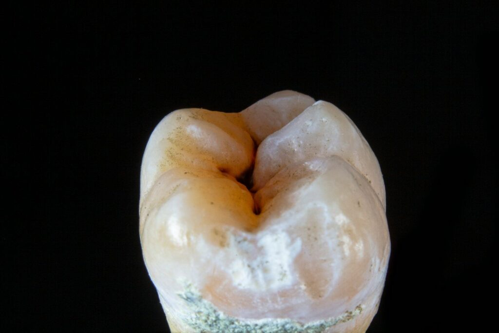 How Long Does It Take to Fill a Cavity? Procedure, Time, and What to Expect how long does it take to fill a cavity